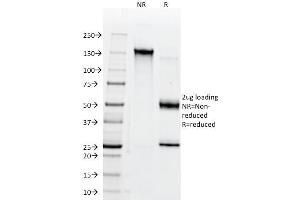 SDS-PAGE Analysis Purified CD147 Mouse Monoclonal Antibody (BSG/963). (CD147 抗体)