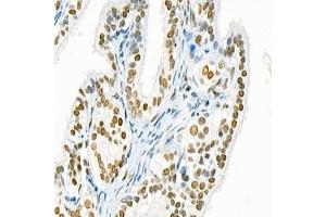 Immunohistochemistry analysis of paraffin-embedded rat ovary using,Mettl11a (ABIN7074612) at dilution of 1: 1500 (METTL11A 抗体)