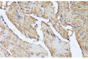 Immunohistochemistry of paraffin-embedded Mouse heart using HAL Polyclonal Antibody at dilution of 1:100 (40x lens). (HAL 抗体)