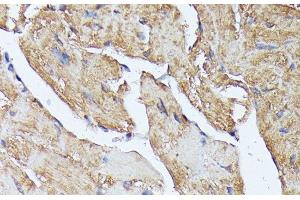 Immunohistochemistry of paraffin-embedded Mouse heart using HAL Polyclonal Antibody at dilution of 1:100 (40x lens).
