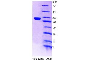 SDS-PAGE analysis of Rat PTPN14 Protein. (PTPN14 蛋白)