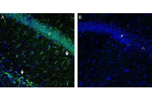 Expression of GPR43/FFAR2 in mouse hippocampus. (FFAR2 抗体  (C-Term, Intracellular))