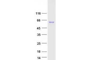 Western Blotting (WB) image for Cathepsin C (CTSC) (Transcript Variant 1) protein (Myc-DYKDDDDK Tag) (ABIN2713232)