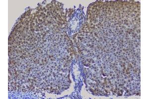 IHC analysis of NRF1 using anti-NRF1 antibody (ABIN6719347).