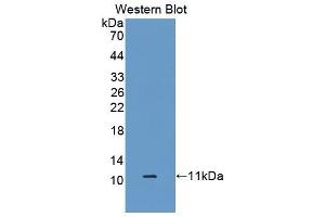 Western blot analysis of the recombinant protein. (S100A6 抗体  (AA 1-90))