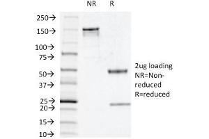 SDS-PAGE Analysis Purified Thymidine Phosphorylase / PD-ECGF Mouse Monoclonal Antibody (P-GF. (Thymidine Phosphorylase 抗体)