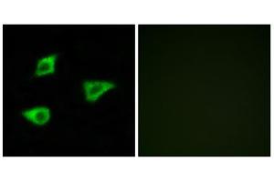 Immunofluorescence analysis of LOVO cells, using CHRM4 antibody. (CHRM4 抗体  (Internal Region))