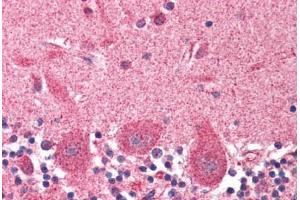 Human Brain, Cerebellum (formalin-fixed, paraffin-embedded) stained with DCTN1 antibody ABIN337005 at 2. (Dynactin 1 抗体  (AA 1266-1278))