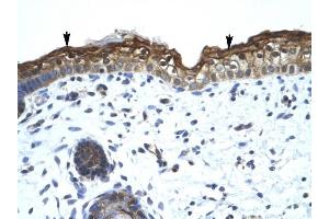 SMARCA2 antibody was used for immunohistochemistry at a concentration of 4-8 ug/ml to stain Squamous epithelial cells (arrows) in Human Skin. (SMARCA2 抗体  (Middle Region))