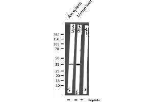 Western blot analysis of EFNB2 expression in various lysates (Ephrin B2 抗体  (C-Term))