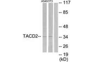 Western blot analysis of extracts from A549/NIH-3T3 cells, using TACD2 Antibody. (TACSTD2 抗体  (AA 131-180))