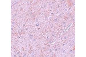 Immunohistochemical staining of rat brain tissue with PIAS2 polyclonal antibody  at 5 ug/mL dilution. (PIAS2 抗体  (N-Term))