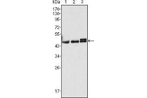 Western blot analysis using CK17 mouse mAb against Hela (1), MCF-7 (2) and A431 (3) cell lysate. (KRT17 抗体)