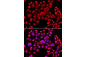 Immunofluorescence analysis of  cells using PIP4K2B antibody (ABIN6130646, ABIN6145675, ABIN6145677 and ABIN6216199). (PIP4K2B 抗体  (AA 1-270))