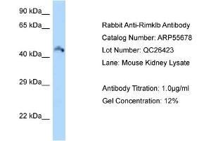 Western Blotting (WB) image for anti-Ribosomal Modification Protein RimK-Like Family Member B (RIMKLB) (Middle Region) antibody (ABIN2786316)