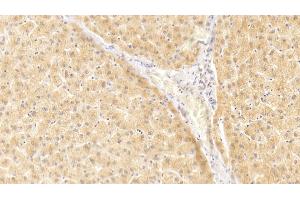 Detection of IL1a in Human Liver Tissue using Polyclonal Antibody to Interleukin 1 Alpha (IL1a) (IL1A 抗体  (AA 113-271))