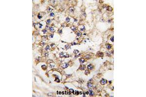 Formalin-fixed and paraffin-embedded human testis tissue reacted with PDX1 polyclonal antibody  , which was peroxidase-conjugated to the secondary antibody, followed by DAB staining. (PDX1 抗体  (N-Term))
