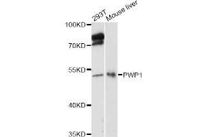 Western blot analysis of extracts of various cell lines, using PWP1 antibody (ABIN6293029) at 1:3000 dilution. (PWP1 抗体)