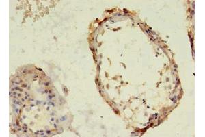 Immunohistochemistry (IHC) image for anti-TBC1 Domain Family, Member 2 (TBC1D2) (AA 1-237) antibody (ABIN7171610)