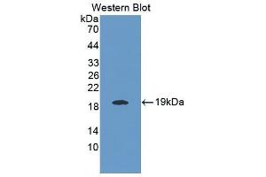 Western Blotting (WB) image for anti-Interleukin 25 (IL25) (AA 33-169) antibody (ABIN1868646) (IL-25 抗体  (AA 33-169))