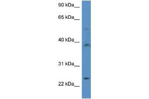 WB Suggested Anti-ACOT9 Antibody Titration: 1. (ACOT9 抗体  (C-Term))