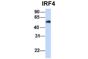 Host:  Rabbit  Target Name:  IRF4  Sample Type:  Human Fetal Muscle  Antibody Dilution:  1. (IRF4 抗体  (Middle Region))