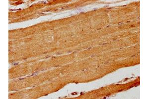 IHC image of ABIN7157686 diluted at 1:200 and staining in paraffin-embedded human skeletal muscle tissue performed on a Leica BondTM system. (ANKRD15 抗体  (AA 66-255))