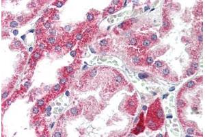 Human Kidney (formalin-fixed, paraffin-embedded) stained with ATG7 antibody ABIN307175 at 5 ug/ml followed by biotinylated goat anti-rabbit IgG secondary antibody ABIN481713, alkaline phosphatase-streptavidin and chromogen. (ATG7 抗体  (C-Term))