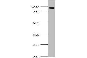 Western blot All lanes: Angiomotin antibody at 2 μg/mL + 293T whole cell lysate Secondary Goat polyclonal to rabbit IgG at 1/10000 dilution Predicted band size: 119, 73 kDa Observed band size: 119 kDa (Angiomotin 抗体  (AA 1-300))