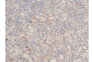 ABIN6267073 at 1/100 staining human appendiceal tissue sections by IHC-P. (CHEK1 抗体  (pSer280))