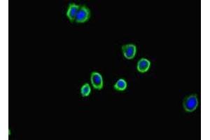 Immunofluorescent analysis of HepG2 cells using ABIN7143790 at dilution of 1:100 and Alexa Fluor 488-congugated AffiniPure Goat Anti-Rabbit IgG(H+L) (alpha 2 Macroglobulin 抗体  (AA 1216-1467))