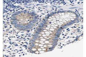 Immunohistochemistry (IHC) image for anti-Nitric Oxide Synthase 2, Inducible (NOS2) (pTyr151) antibody (ABIN6256645)