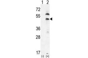 Western blot analysis of PDGFRL and 293 cell lysate either nontransfected (Lane 1) or transiently transfected (2) with the PDGFRL gene. (PDGFRL 抗体  (AA 328-357))
