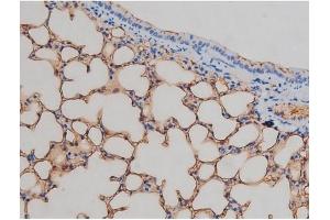 ABIN6267337 at 1/200 staining Mouse lung tissue sections by IHC-P. (IGF1R 抗体  (pTyr1161))