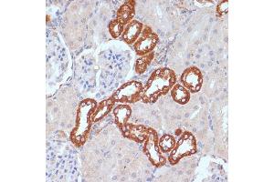 Immunohistochemistry (IHC) image for anti-Platelet Derived Growth Factor Receptor beta (PDGFRB) (AA 887-1106) antibody (ABIN3023139)