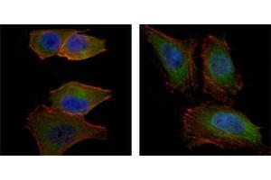 Immunofluorescence analysis of PANC-1 (left) and Hela (right) cells using AKT2 mouse mAb (green). (AKT2 抗体)