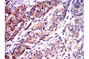 Immunohistochemistry (IHC) image for anti-Neurofilament, Light Polypeptide (NEFL) antibody (ABIN1108416)