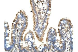 KARS antibody was used for immunohistochemistry at a concentration of 4-8 ug/ml to stain Epithelial cells of intestinal villus (arrows) in Human Intestine. (KARS 抗体  (C-Term))