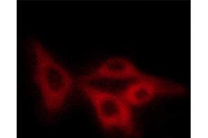 ABIN6267404 staining COS7 cells by ICC/IF. (Stathmin 1 抗体  (pSer15))