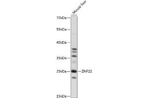 Western blot analysis of extracts of mouse liver, using ZNF22 antibody (ABIN7271468) at 1:1000 dilution. (Zinc Finger Protein 22 抗体  (AA 1-224))