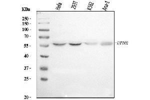 Western blot analysis of IMPDH1 using anti-IMPDH1 antibody (ABIN7599864).