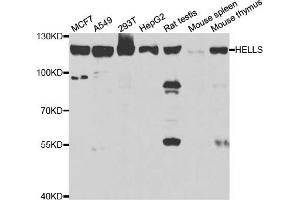 Western blot analysis of extracts of various cell lines, using HELLS antibody (ABIN5973444) at 1/1000 dilution. (HELLS 抗体)