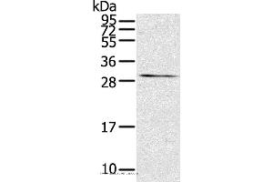 Western blot analysis of Mouse kidney tissue, using TNFSF15 Polyclonal Antibody at dilution of 1:600 (TNFSF15 抗体)