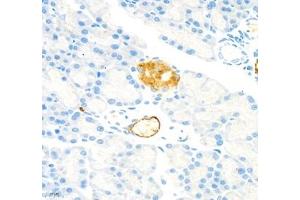 Immunohistochemistry of paraffin embedded rat pancreatic using MADCAM1 (ABIN7074695) at dilution of 1:1800 (400x lens) (MADCAM1 抗体)