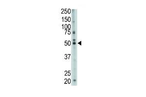 The anti-FDFT1 Pab (ABIN389051 and ABIN2839260) is used in Western blot to detect FDFT1 in mouse cerebellum tissue lysate. (FDFT1 抗体  (N-Term))