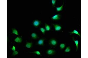 Immunofluorescence staining of A549 cells with ABIN7148527 at 1:100, counter-stained with DAPI. (CPNE7 抗体  (AA 254-393))