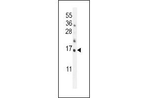 Hrk-BH3 (ABIN388104 and ABIN2846212) western blot analysis in mouse kidney tissue lysates (35 μg/lane). (HRK 抗体  (AA 15-50))