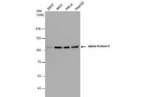 WB Image alpha Actinin 1 antibody detects alpha Actinin 1 protein by western blot analysis. (ACTN1 抗体)