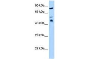 Image no. 1 for anti-Testis Derived Transcript (3 LIM Domains) (TES) (AA 203-252) antibody (ABIN6748070) (TES 抗体  (AA 203-252))