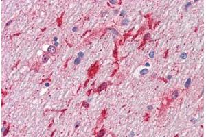 Human Brain, Cerebellum, White Matter (formalin-fixed, paraffin-embedded) stained with HGF antibody ABIN461958 at 10 ug/ml followed by biotinylated anti-mouse IgG secondary antibody ABIN481714, alkaline phosphatase-streptavidin and chromogen. (HGF 抗体)